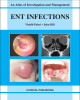 Ebook An atlas of investigation and management - Ent infections: Part 1